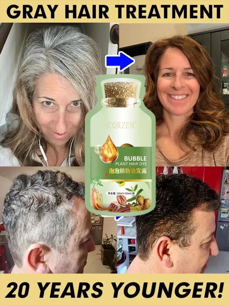gray hair before